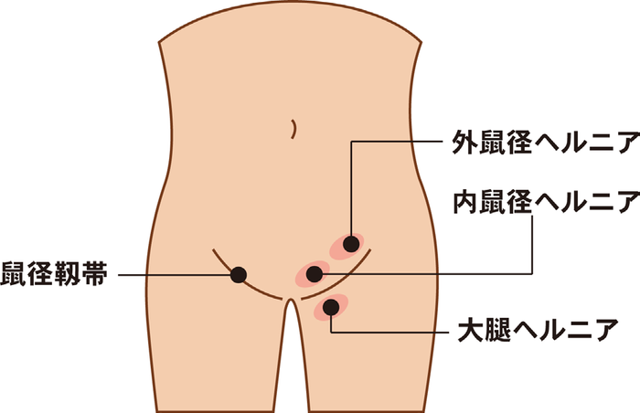 細長い しこり 腹部 左下